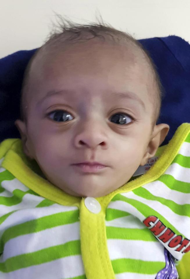 Bé gái sinh ra nhỏ xíu chưa bằng bàn tay, bác sĩ không dám tiên lượng điều gì thì 6 tháng điều kỳ diệu đã xảy ra